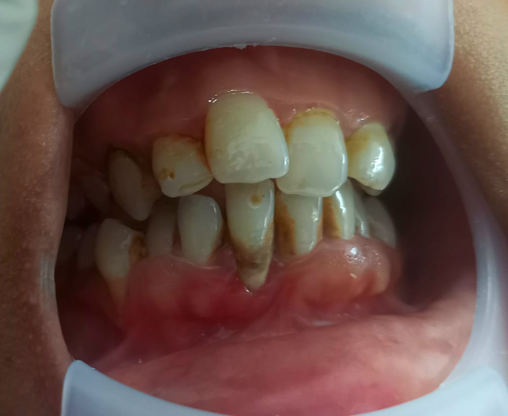 Awareness drive image 2